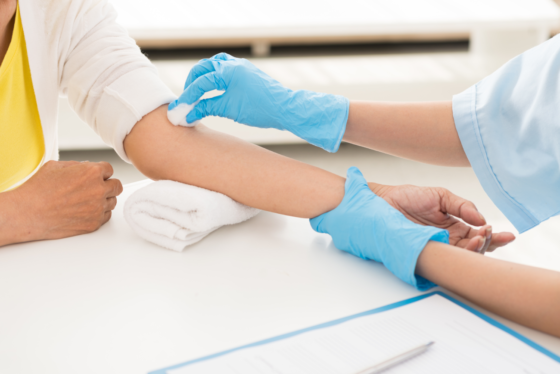 blood test 2023 11 27 05 35 36 utc1 560x374png