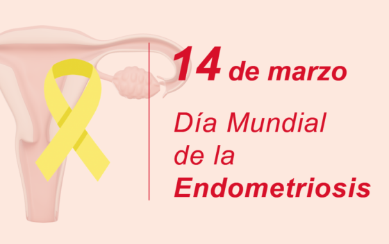 endometriosis2 560x352png