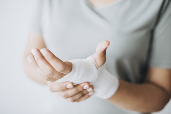 woman with gauze bandage wrapped around her hand 1 560x373jpg