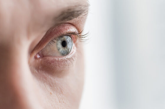 eye guy 560x373jpg