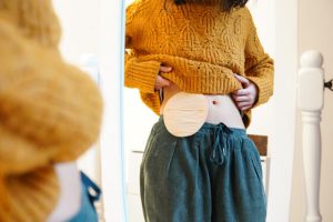 mujer joven irreconocible mirando su bolsa de ostomia en el espejo ostomizada con una colostomia 560x373jpg Advanced Health Laser mujer joven irreconocible mirando su bolsa de ostomia en el espejo ostomizada con una colostomia 560x373jpg